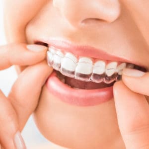 Invisalign provider, teeth straightening solutions, Woodbridge NJ
