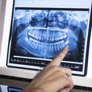 low radiation dental x-rays, dental assessment, Woodbridge NJ